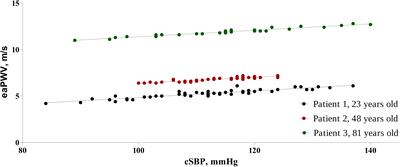 Would Oscillometry be Able to Solve the Dilemma of Blood Pressure Independent Pulse Wave Velocity – A Novel Approach Based on Long-Term Pulse Wave Analysis?